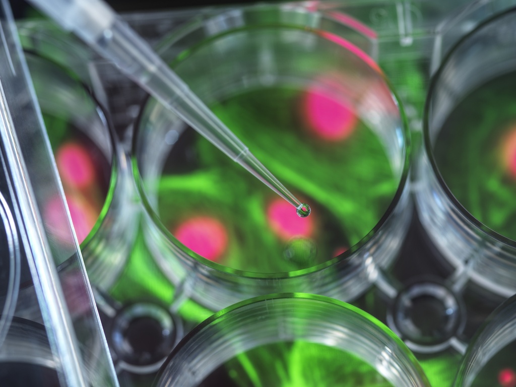 Fluorescent Adrenergic Receptor beta2 Internalization Assay Cell Line